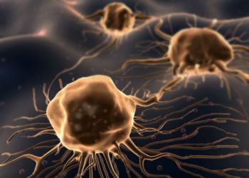 Tumori nella provincia di Latina: in aumento i casi oncologici registrati