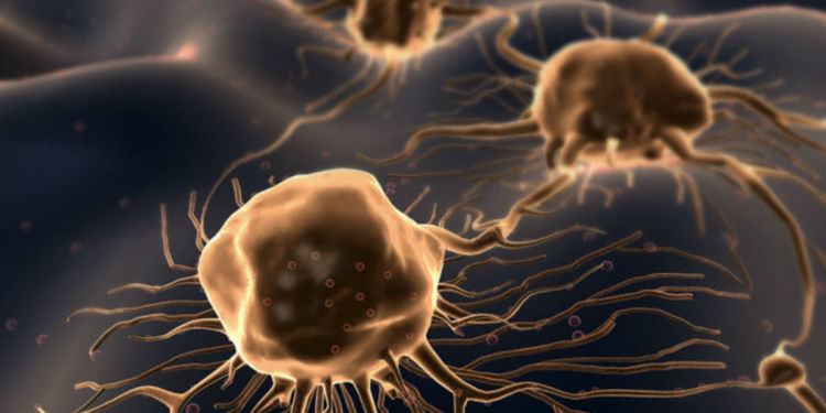 Tumori nella provincia di Latina: in aumento i casi oncologici registrati