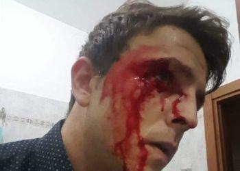 Ponza, aggredito e accoltellato dirigente di Fratelli d’Italia