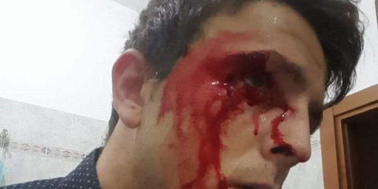 Ponza, aggredito e accoltellato dirigente di Fratelli d’Italia