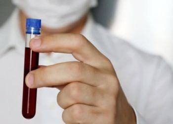 Caso sospetto di Coronavirus in provincia di Latina, negativi i primi test