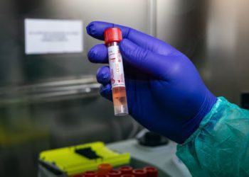 Emergenza Coronavirus, l’Asl: “3 nuovi casi a Latina. Il totale in provincia sale a 212”