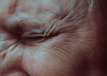 Bellezza: i rimedi per combattere le rughe