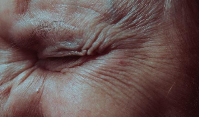Bellezza: i rimedi per combattere le rughe