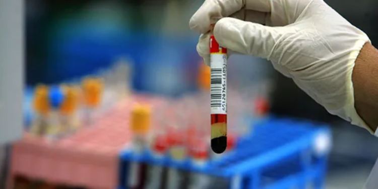 Un segreto che uccide. E’ morto l’uomo di Latina infettato dalla moglie separata